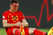 Vermaelen sangra tras una jugada en el partido ante Inglaterra.-REUTERS