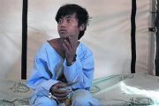 Curado 8Pemba, después de haber sido atentido en el hospital.-AP