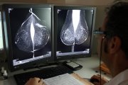 Estudio una mamografía digital, en el servicio de mamografías del Hospital Río Hortega de Valladolid.