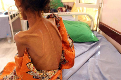Una niña de 12 años con altos niveles de desnutrición en Yemen.-AFP