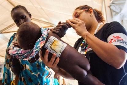 Una enfermera examina a una niña que sufre una infección en la piel, en el hospital de MSF de Malakal (Sudán del Sur), el 15 de junio.-AFP / ALBERT GONZALEZ FARRAN