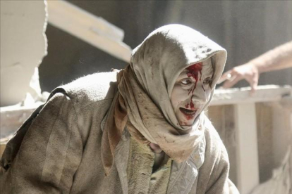 Una mujer herida por los ataques aéreos en Alepo.-REUTERS