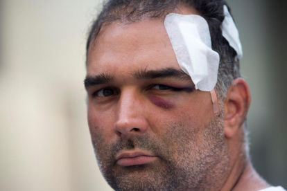 José Bravo, el turista estadounidense de origen cubano que fue agredido el miércoles por un grupo de manteros-QUIQUE GARCIA / EFE