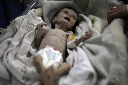 El pequeño Sahar Dofdaa poco antes de morir por desnutrición.-AFP / AMER ALMOHIBANY