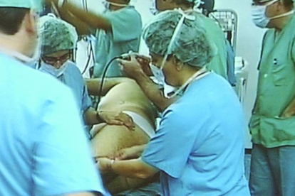 Operación en un quirófano del complejo hospitalario de Soria.-VALENTÍN GUISANDE