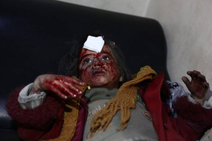 Una niña herida en los bombardeos de este jueves en Ghouta.-Foto: AFP / ABD DOUMANY