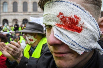 Los chalecos amarillos, con heridas falsas en los ojos, durante una manifestación.-SEBASTIEN BOZON (AFP)