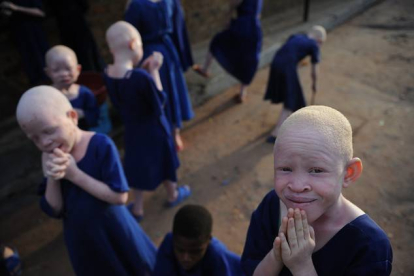 Centro donde se aloja y protege a niños albinos en Tanzania.-Foto: AFP / TONY KARUMBA
