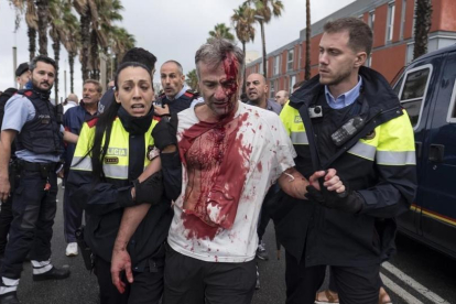 Uno de los heridos en la Escola Mediterrànea de la Barceloneta durante las cartas policiales el 1-O.-EL PERIÓDICO