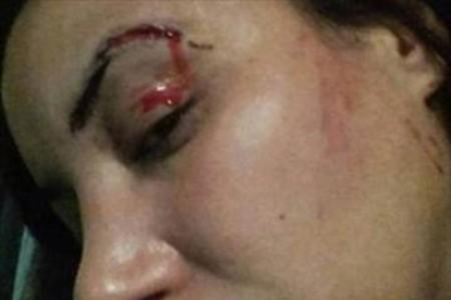 Imagen de la agresión a la actriz Lubna Avidar.-
