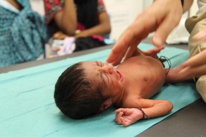 Uno de los bebés.-MSF