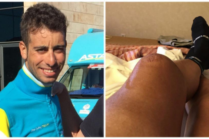 El ciclista italiano Fabio Aru y su maltrecha rodilla.-