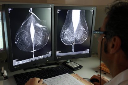 Estudio una mamografía digital, en el servicio de mamografías del Hospital Río Hortega de Valladolid.
