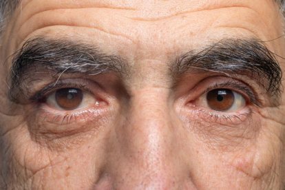 La mayoría de los glaucomas son asintomáticos.