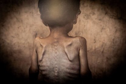 Una sobrecogedora muestra de la mano de OnPhoto