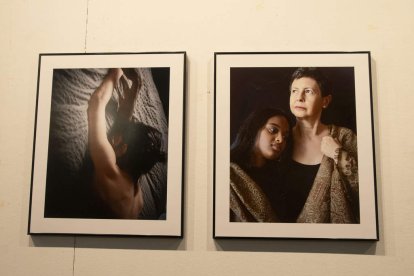 Cada fotografía es un gesto de reconocimiento hacia quienes viven con esclerodermia
