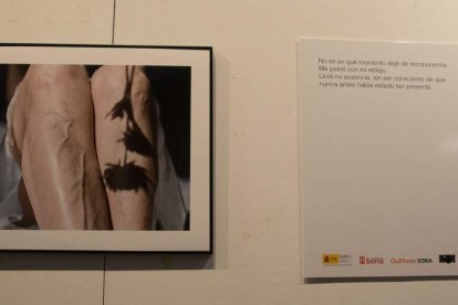 Cada fotografía es un gesto de reconocimiento hacia quienes viven con esclerodermia