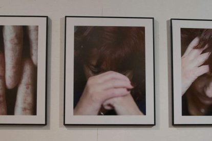 Cada fotografía es un gesto de reconocimiento hacia quienes viven con esclerodermia