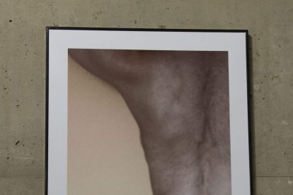 Cada fotografía es un gesto de reconocimiento hacia quienes viven con esclerodermia