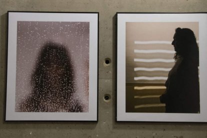 Cada fotografía es un gesto de reconocimiento hacia quienes viven con esclerodermia