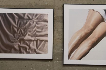 Cada fotografía es un gesto de reconocimiento hacia quienes viven con esclerodermia