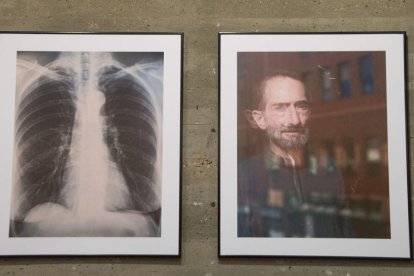 Cada fotografía es un gesto de reconocimiento hacia quienes viven con esclerodermia