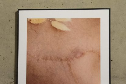 Cada fotografía es un gesto de reconocimiento hacia quienes viven con esclerodermia