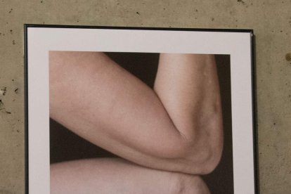 Cada fotografía es un gesto de reconocimiento hacia quienes viven con esclerodermia