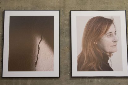 Cada fotografía es un gesto de reconocimiento hacia quienes viven con esclerodermia