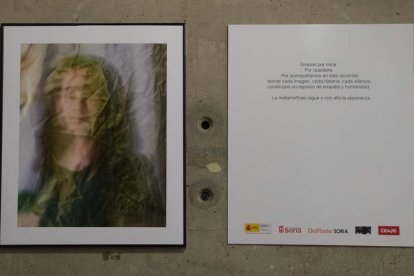 Cada fotografía es un gesto de reconocimiento hacia quienes viven con esclerodermia