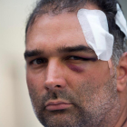 José Bravo, el turista estadounidense de origen cubano que fue agredido el miércoles por un grupo de manteros-QUIQUE GARCIA / EFE