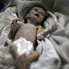 El pequeño Sahar Dofdaa poco antes de morir por desnutrición.-AFP / AMER ALMOHIBANY