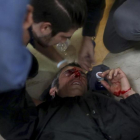 Un manifestante es atendido después de ser golpeado por una bala de goma disparada en la escuela Ramón Llull.-MANU BRABO/AP