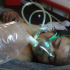 Un niño sirio recibe tratamiento tras el ataque con gas tóxico.-AFP / MOHAMED AL-BAKOUR