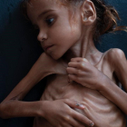 La niña Amal, fallecida por desnutrición-TYLER HICKS (THE NEW YORK TIMES)