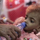 Un padre da de beber a su hija desnutrida el pasado mes de septiembre en un centro hospitalario de Hodeida, ciudad bombardeada por Arabia Saudí y sus aliados.-AP / HANI MOHAMMED