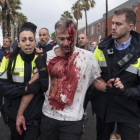 Uno de los heridos en la Escola Mediterrànea de la Barceloneta durante las cartas policiales el 1-O.-EL PERIÓDICO