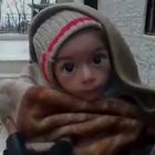 Un bebé desnutrido en Madaya.-REUTERS
