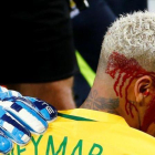Neymar, tras recibir el codazo ante Bolivia.-REUTERS / RICARDO MORAES