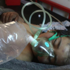 Un niño sirio recibe tratamiento tras el ataque con gass tóxico.-MOHAMED AL-BAKOUR