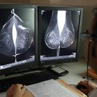 Estudio una mamografía digital, en el servicio de mamografías del Hospital Río Hortega de Valladolid.