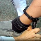 Colocación de una pulsera antimaltrato.