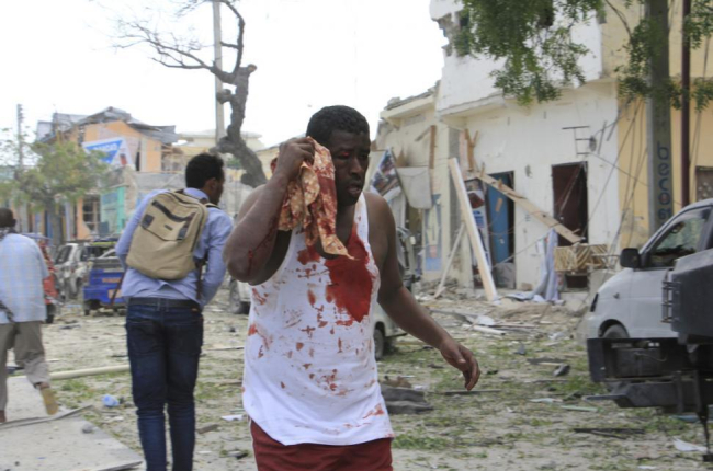 Un herido en el ataque al hotel Dayah de Mogadiscio.-FARAH ARBI WARSAMEH / AP