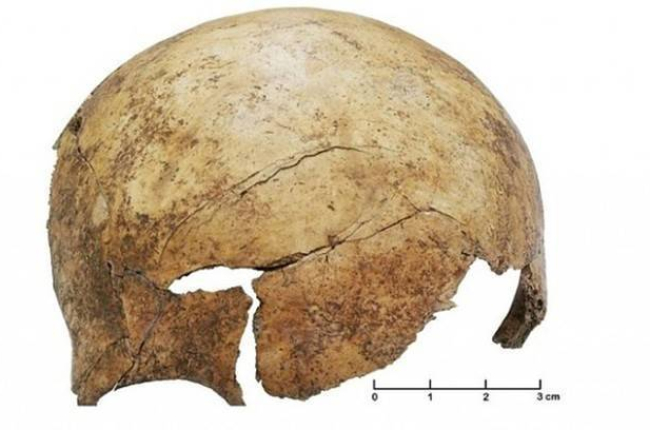 Cráneo de un niño encontrado en el yacimiento paleolítico de Schöneck-Kilianstädten, en Alemania, con restos evidentes de haber sido golpeado violentamente.-Foto: PNAS