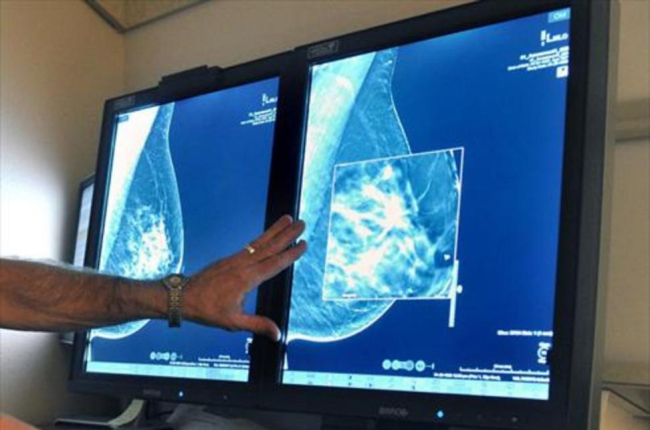 Un radiólogo compara dos mamografías para detectar tumores.-/ AP