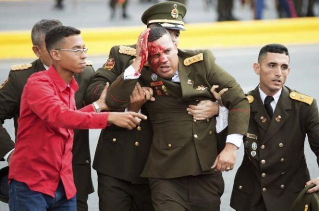 Un militar herido tras el atentado con drones a Nicolás Maduro en Venezuela.-AP / XINHUA