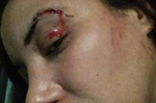 Imagen de la agresión a la actriz Lubna Avidar.-