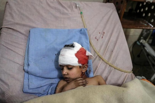 Un niño herido en los bombardeos de las fuerzas leales a Damasco recibe tratamiento en un hospital de Duma.-EFE / MOHAMMED BADRA