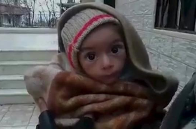 Un bebé desnutrido en Madaya.-REUTERS