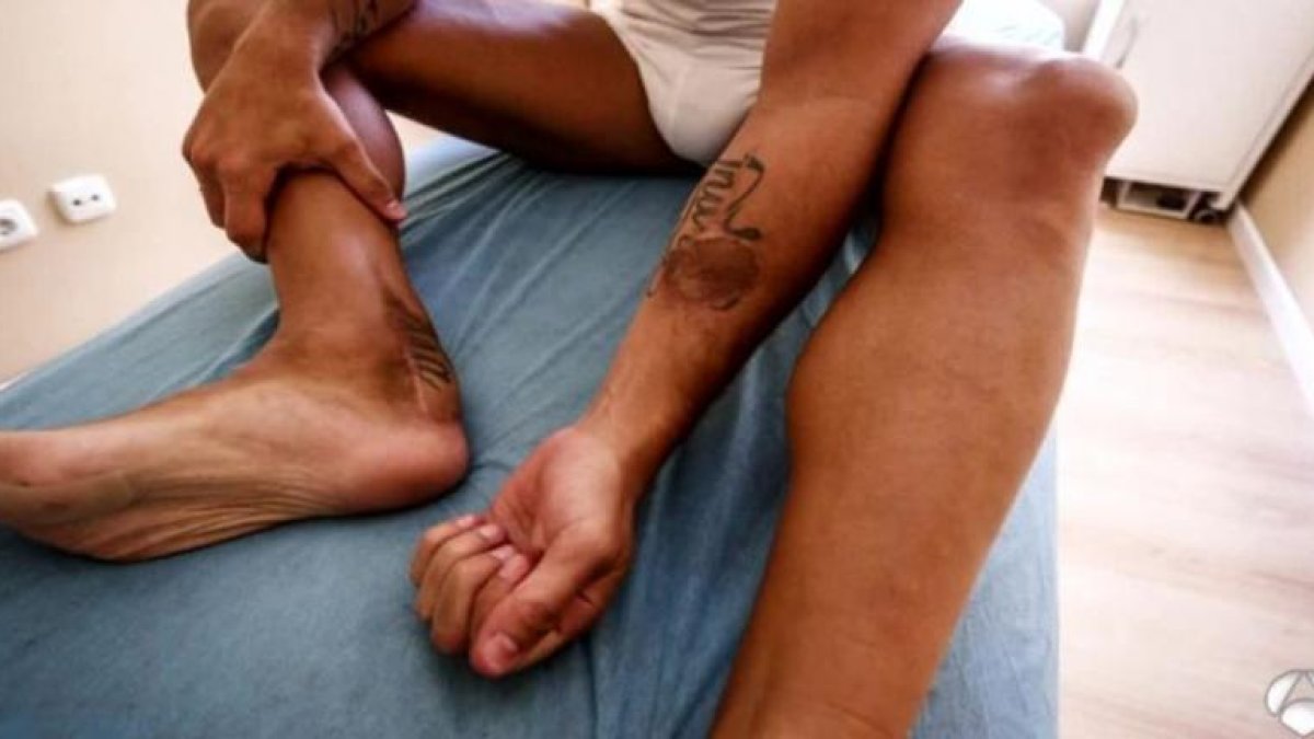 Santi Cazorla muestra el injerto de piel que le hizieron, con piel del antebrazo-EL PERIÓDICO